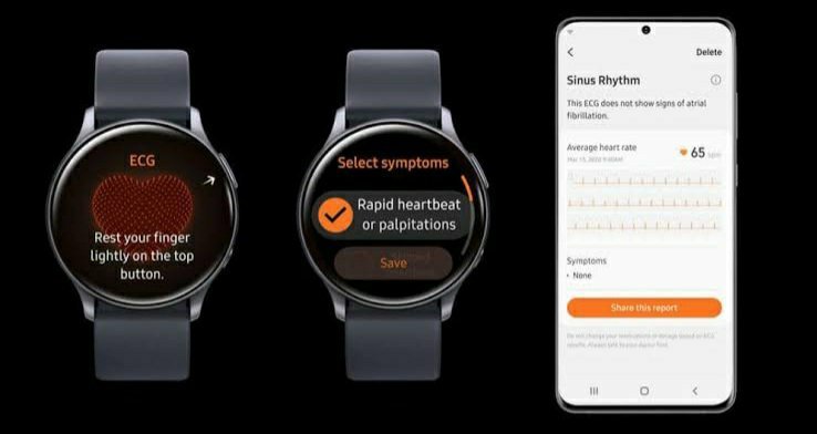 ECG on Galaxy Watch 3