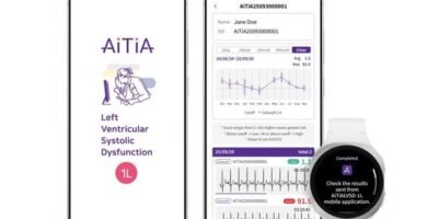 AI-Powered Galaxy Wearables Could Reveal Heart Issues and Brain Insights