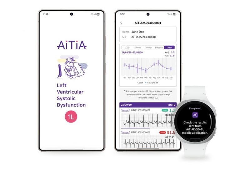 AI-Powered Galaxy Wearables Could Reveal Heart Issues and Brain Insights